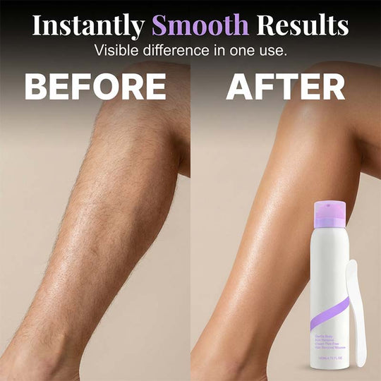 💜2026 Hot Sale 75% OFF Only￡9.99！！✨🧴Gentle Painless Hair Removal Mousse Removes Hair Gently While Moisturizing Skin! 💖